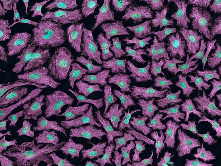 Stained HeLa cells.